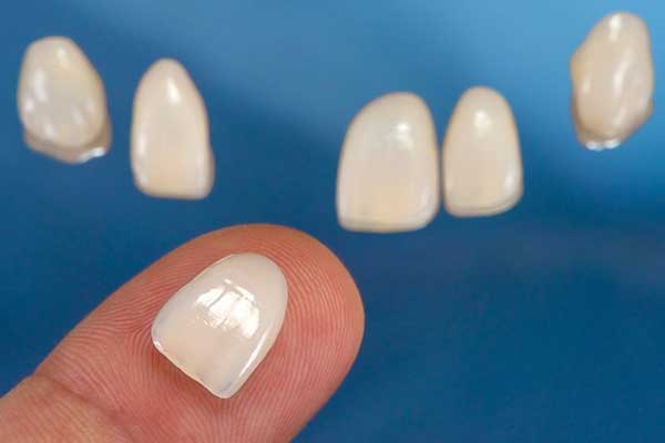 Porcelain Veneers in East Longmeadow, MA